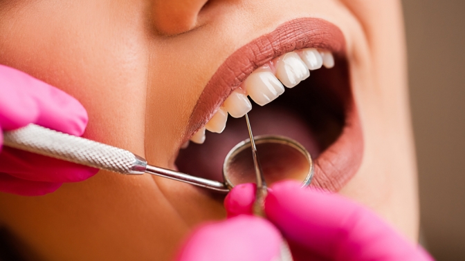 Чистка зубов с полировкой, лечение кариеса в клинике «Москва Мед»